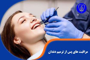 مراقبت های پس از ترمیم دندان