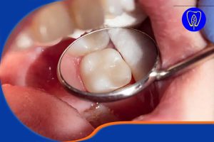 ترمیم دندان