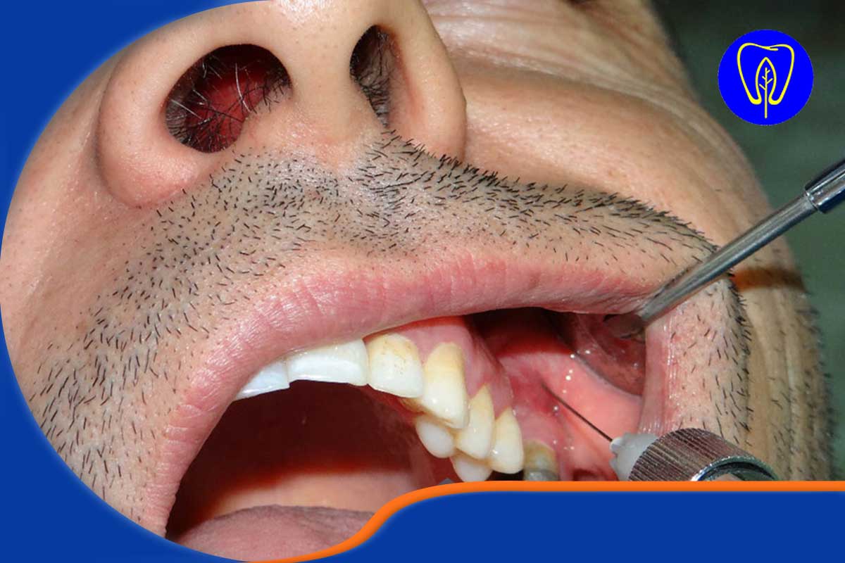 مراحل انجام جراحی فک و دهان: از تشخیص تا درمان