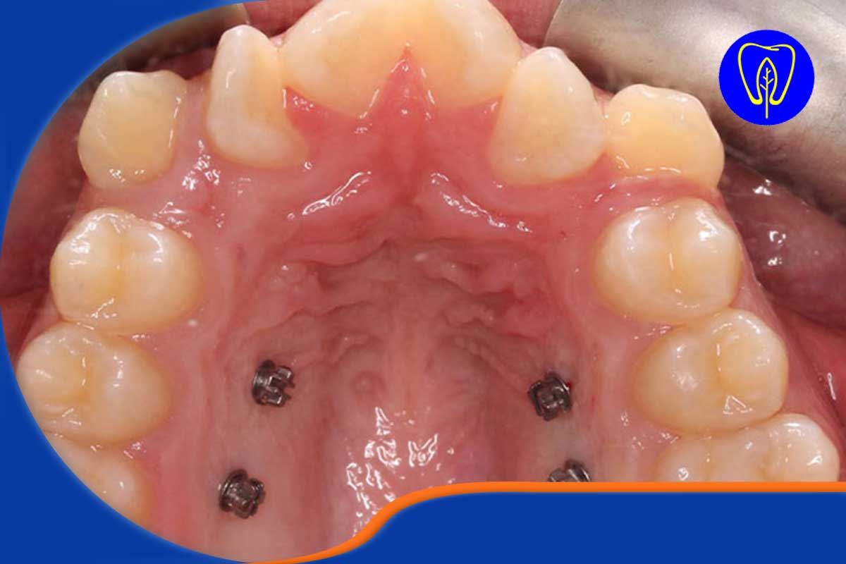 چه زمانی به متخصص جراحی فک و دهان نیاز داریم؟
