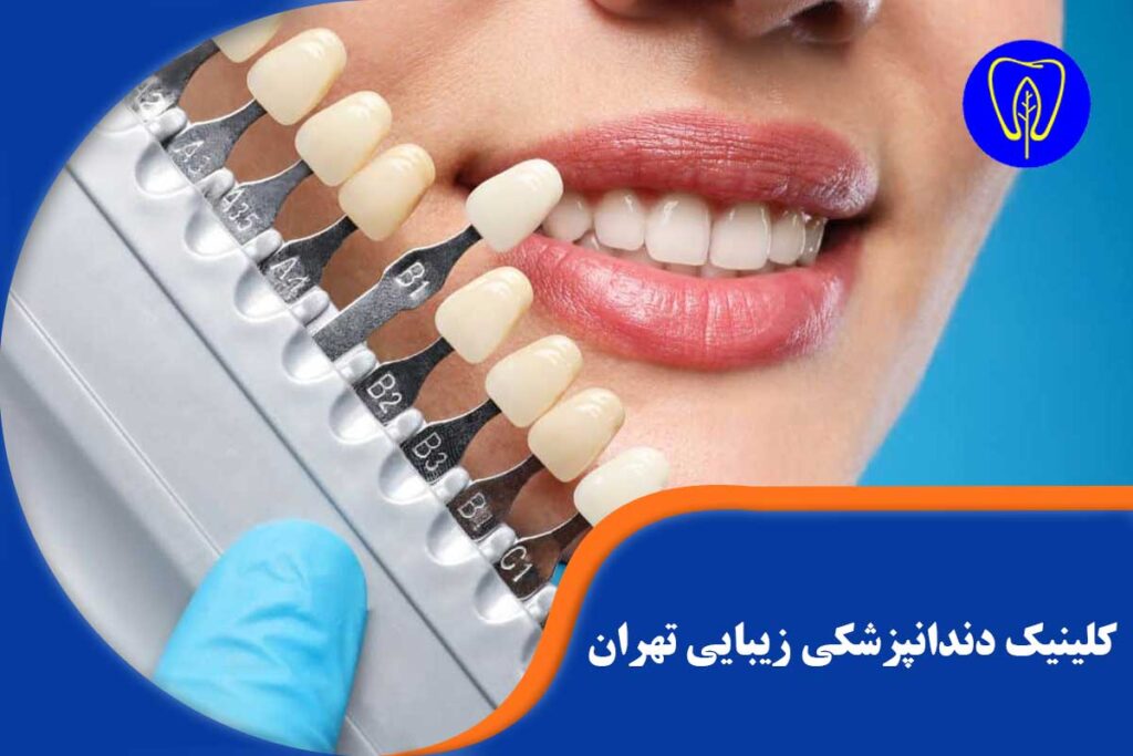 دندانپزشکی زیبایی