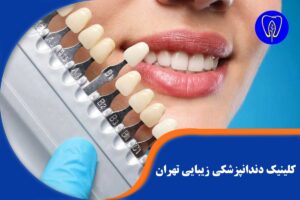 دندانپزشکی زیبایی