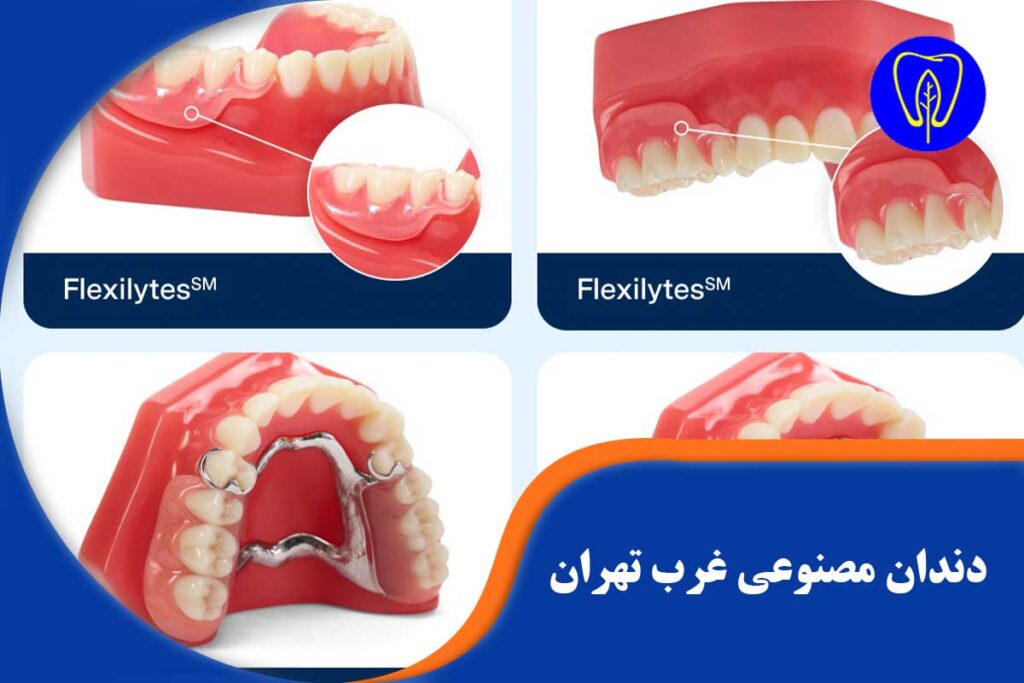 دندان مصنوعی در غرب تهران
