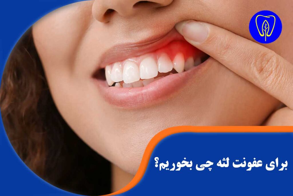 برای عفونت لثه چی بخوریم
