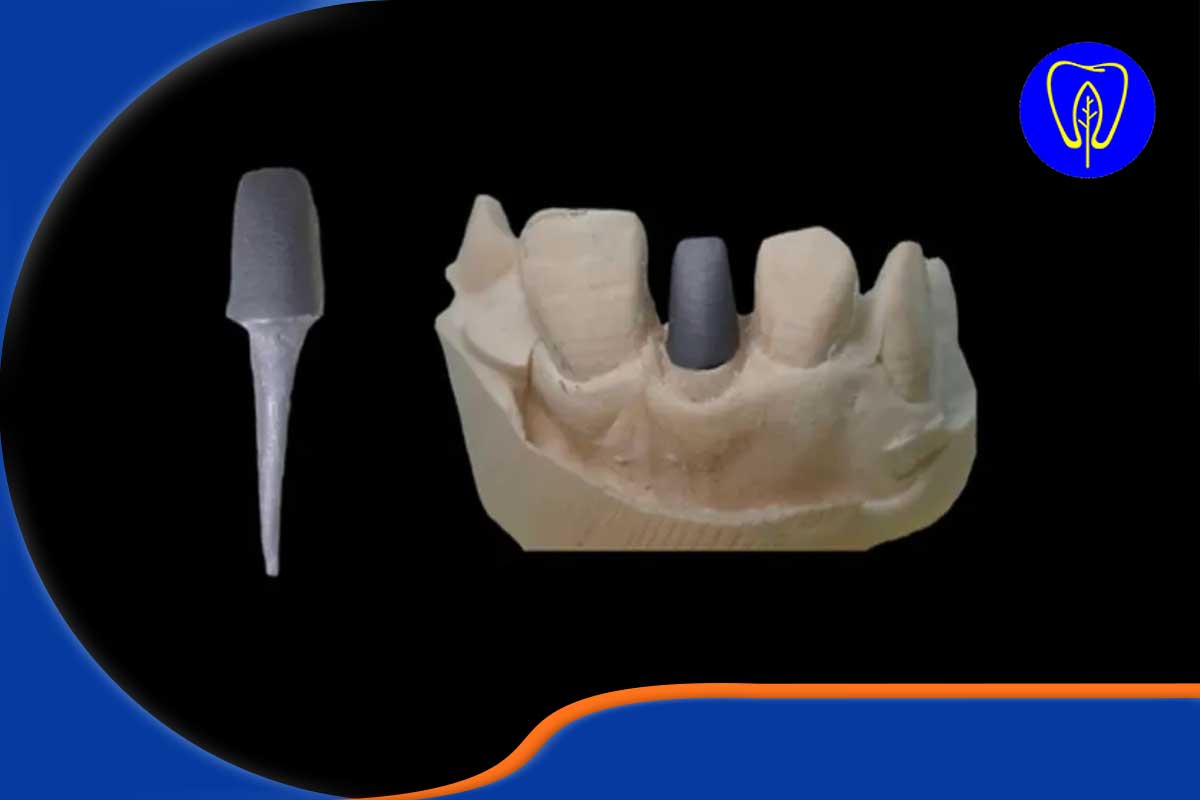 پست و کور (Post and Core) دقیقاً چیست و چگونه عمل می‌کند؟