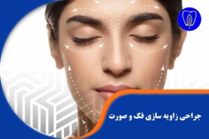جراحی زاویه سازی فک و صورت: تغییر ماندگار چهره و اصلاح ساختار اسکلتی