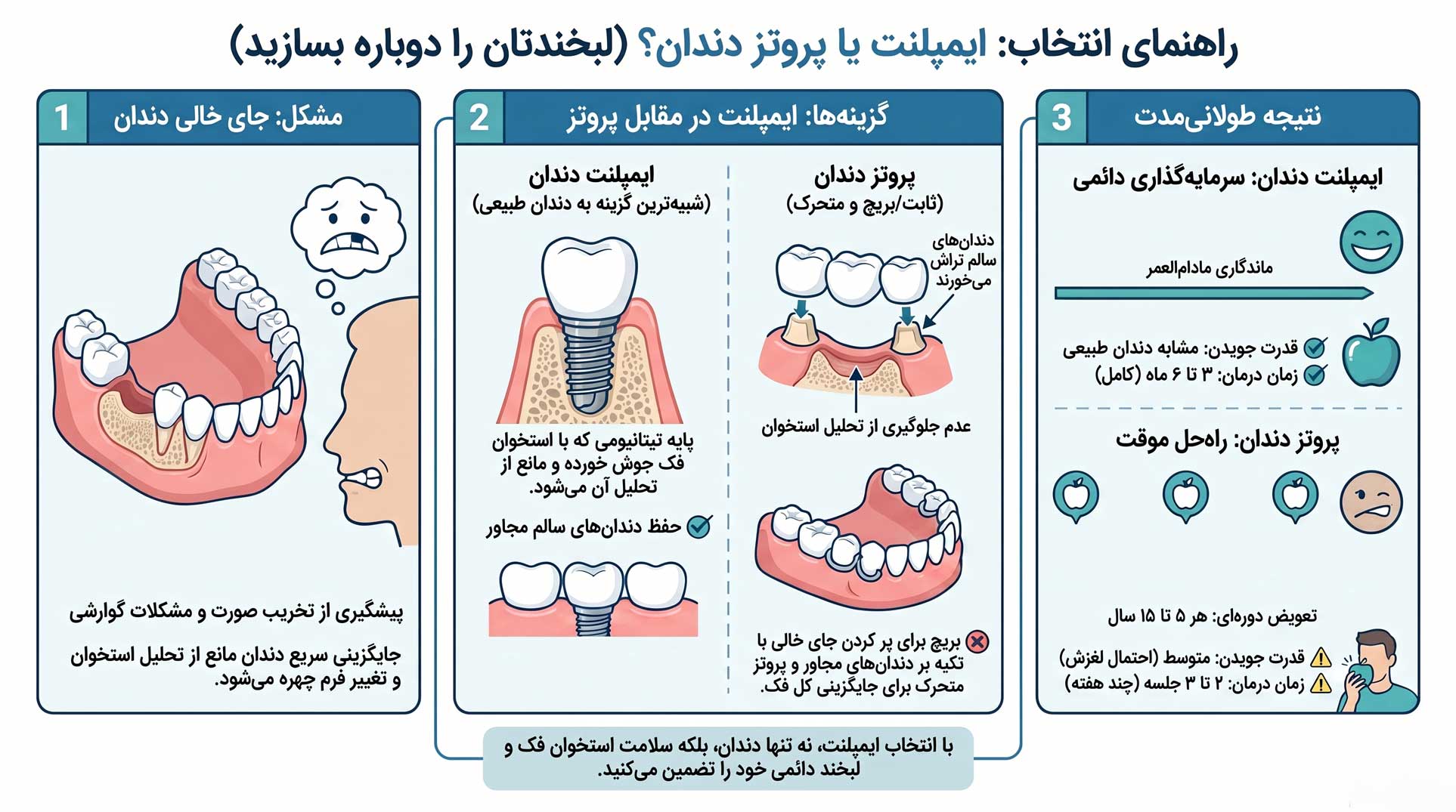 انتخاب بین پروتز دندان و ایمپلنت