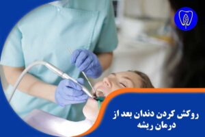 روکش کردن دندان بعد از درمان ریشه
