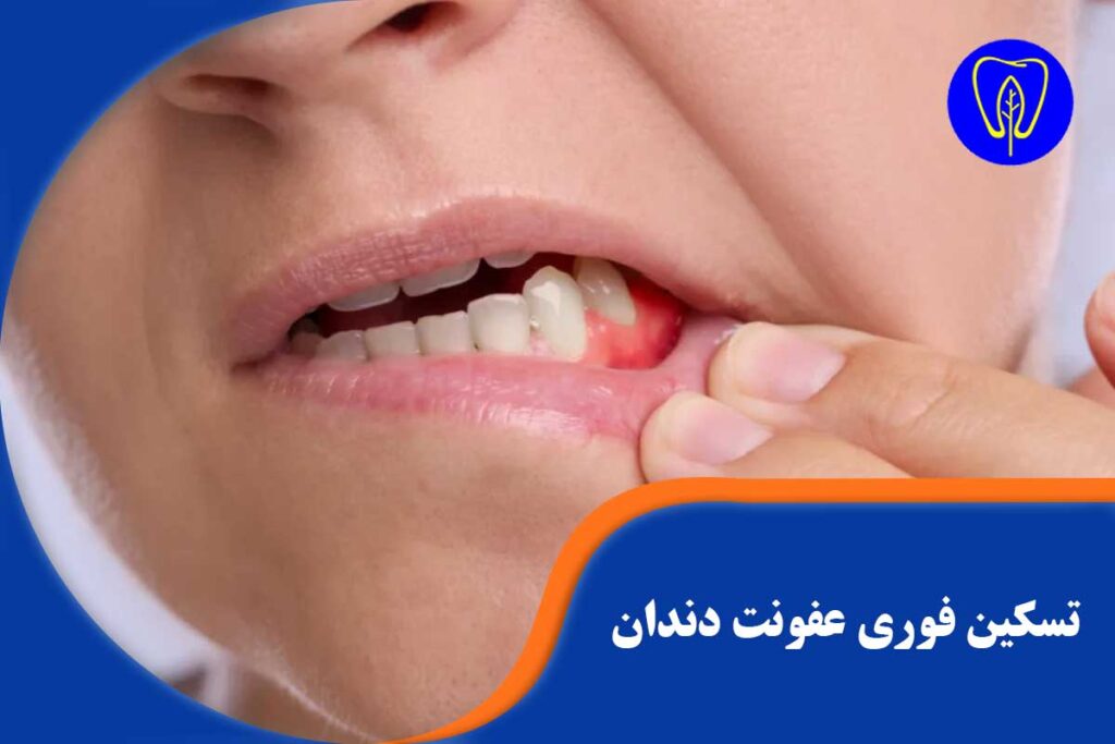تسکین فوری عفونت دندان