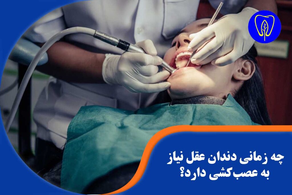 عصب‌کشی دندان عقل